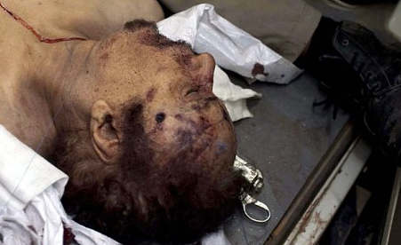 Purported bullethole wound of Gaddafi