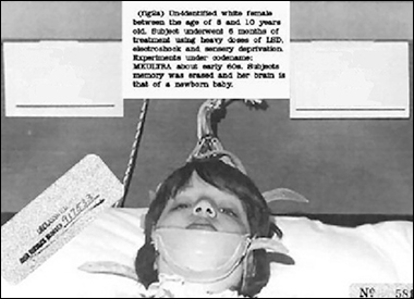Image depicts underage white female between ages of 8 and 10 who underwent MKUltra research, including treatment using heavy doses of LSD, electroshock therapy and sensory deprivation.